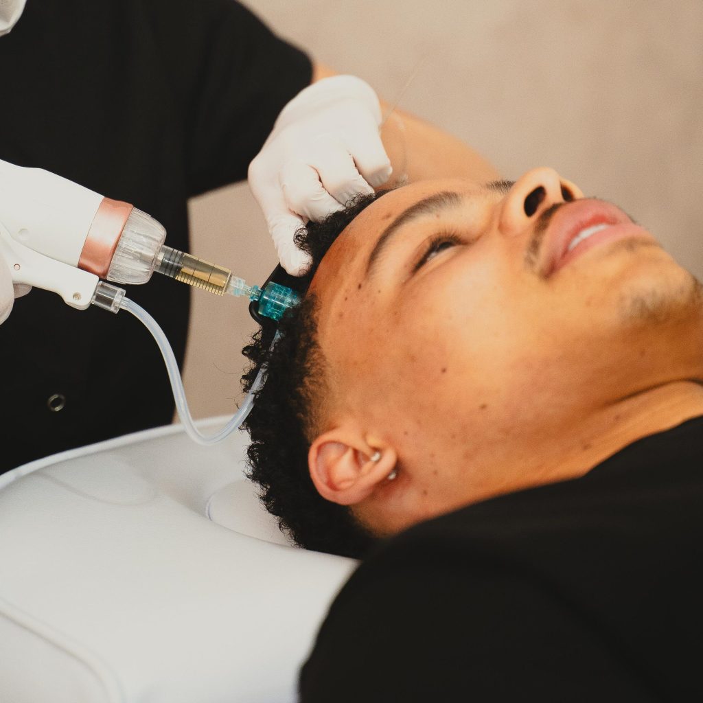 Mesotherapie voor het haar bij LZ Clinics Amsterdam